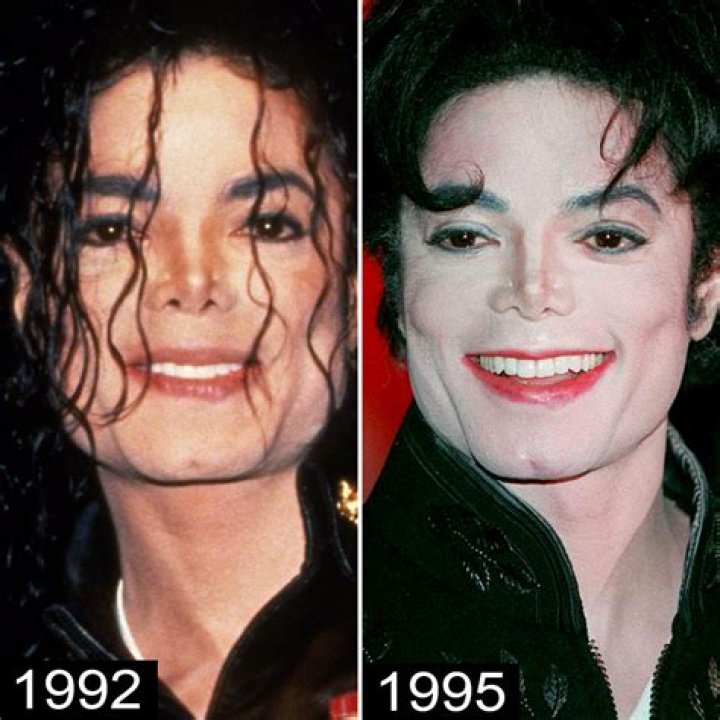 Uncover The Evolution Of Michael Jackson: Before And After